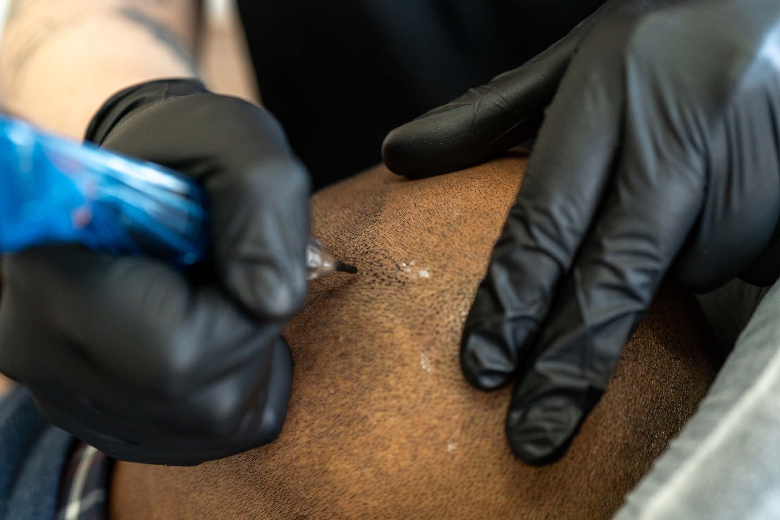 Scalp micropigmentation Australia - SMP HQ in Melbourne